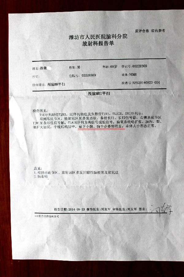 纯中药治疗小脑萎缩2个月mri影像对比资料