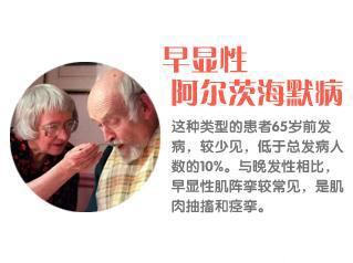 早显性阿尔茨海默病